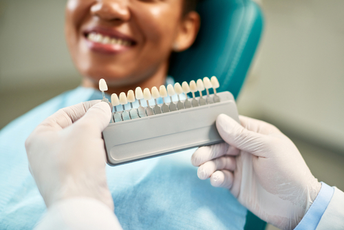 Veneers Cost in Harrisburg, NC | Cosmetic Dentistry | Dr. Ney